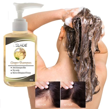 Ginseng-Ul Anti-Caderea Parului Sampon Tratament Puternic Esența Ierburi Ghimbir Cooler De Creștere A Părului, Loțiuni Pentru Barbati Femei