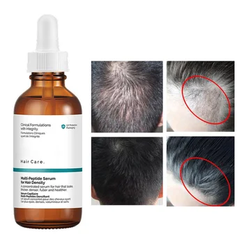 Multi-Peptide Ser Pentru o Densitate de Păr de Păr de Creștere Stufoasă Sănătate, Putere de Polipeptide Scalp Ser de Îngrijire a Părului 60ml